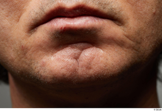  HD Face Skin Benito Romero chin face lips mouth scar skin pores skin texture 0002.jpg